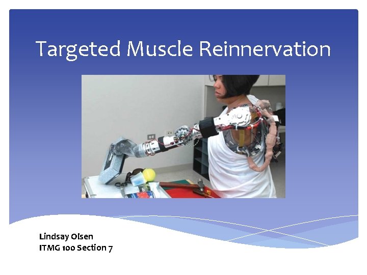 Targeted Muscle Reinnervation Lindsay Olsen ITMG 100 Section 7 