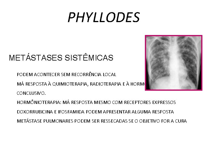 PHYLLODES METÁSTASES SISTÊMICAS PODEM ACONTECER SEM RECORRÊNCIA LOCAL MÁ RESPOSTA À QUIMIOTERAPIA, RADIOTERAPIA E