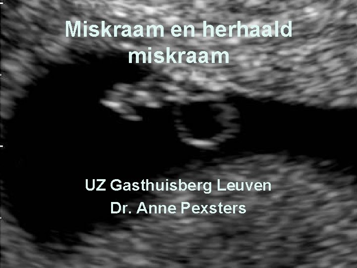 Miskraam en herhaald miskraam UZ Gasthuisberg Leuven Dr. Anne Pexsters 