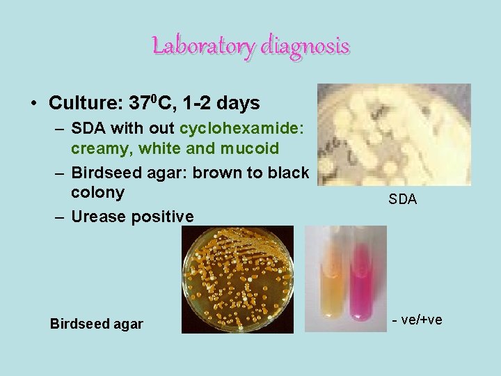 Laboratory diagnosis • Culture: 370 C, 1 -2 days – SDA with out cyclohexamide: