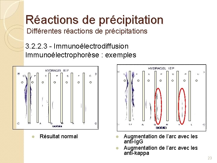 Réactions de précipitation Différentes réactions de précipitations 3. 2. 2. 3 - Immunoélectrodiffusion Immunoélectrophorèse