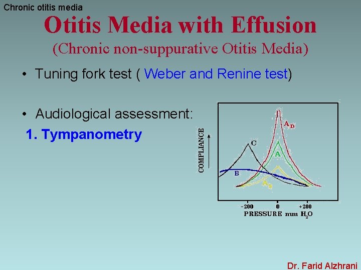 Chronic otitis media Otitis Media with Effusion (Chronic non-suppurative Otitis Media) • Tuning fork
