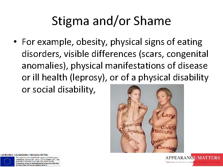 Stigma and/or Shame • For example, obesity, physical signs of eating disorders, visible differences