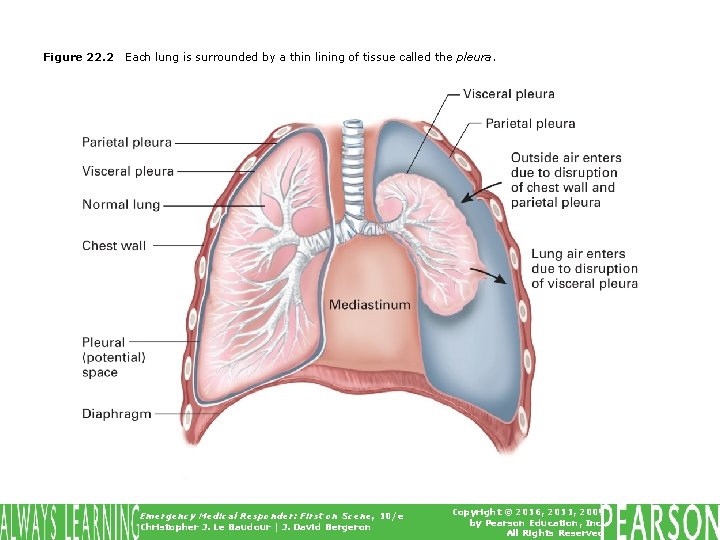 Figure 22. 2 Each lung is surrounded by a thin lining of tissue called