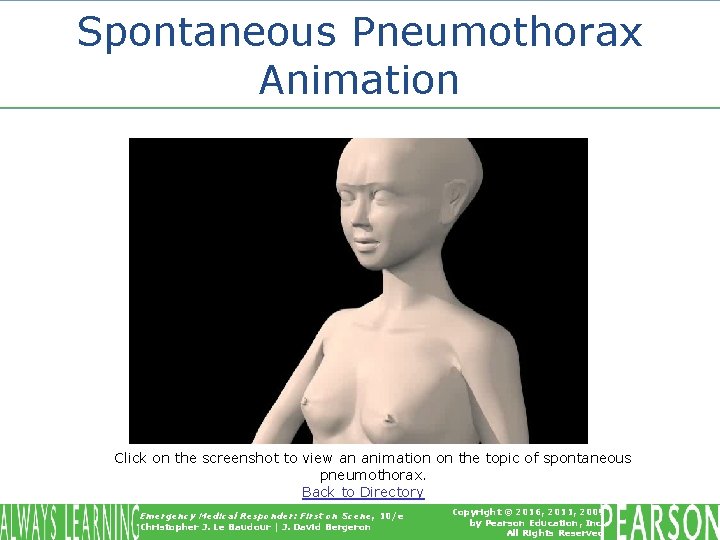 Spontaneous Pneumothorax Animation Click on the screenshot to view an animation on the topic