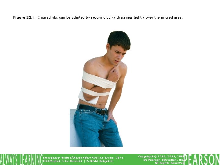 Figure 22. 4 Injured ribs can be splinted by securing bulky dressings tightly over