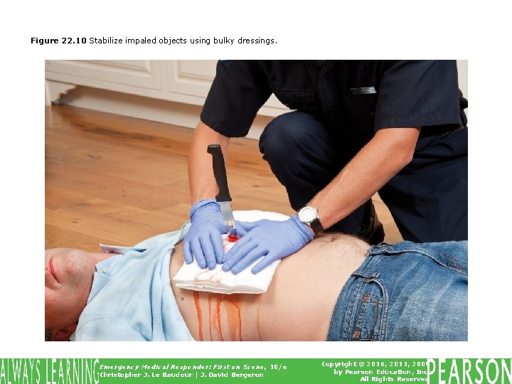 Figure 22. 10 Stabilize impaled objects using bulky dressings. Emergency Medical Responder: First on