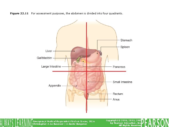 Figure 22. 11 For assessment purposes, the abdomen is divided into four quadrants. Emergency