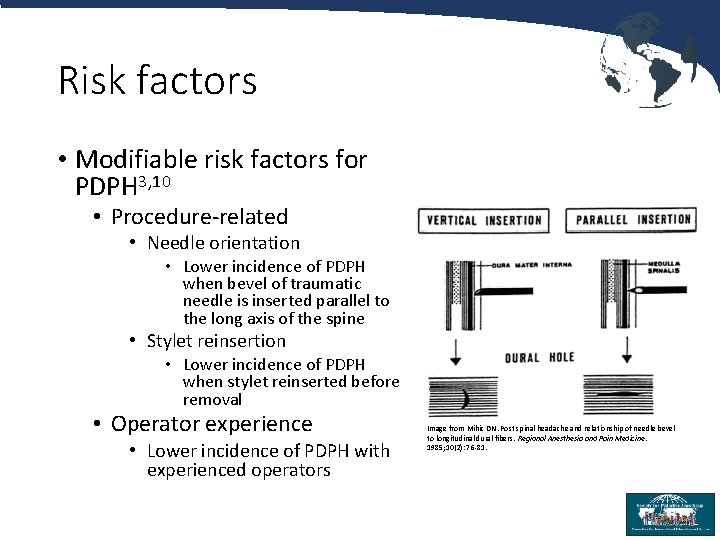 Risk factors • Modifiable risk factors for PDPH 3, 10 • Procedure-related • Needle