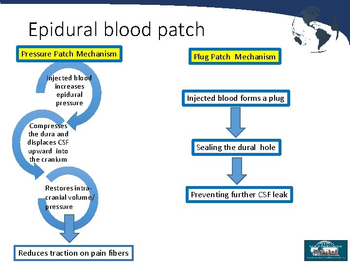 Epidural blood patch Pressure Patch Mechanism Injected blood increases epidural pressure Compresses the dura