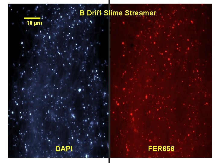 B Drift Slime Streamer 10 µm DAPI FER 656 
