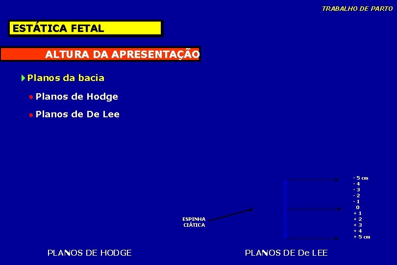 TRABALHO DE PARTO ESTÁTICA FETAL ALTURA DA APRESENTAÇÃO Planos da bacia Planos de Hodge TRABALHO DE PARTO ESTÁTICA FETAL ALTURA DA APRESENTAÇÃO Planos da bacia Planos de Hodge