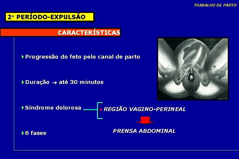 TRABALHO DE PARTO 2 o PERÍODO-EXPULSÃO CARACTERÍSTICAS Progressão do feto pelo canal de parto TRABALHO DE PARTO 2 o PERÍODO-EXPULSÃO CARACTERÍSTICAS Progressão do feto pelo canal de parto