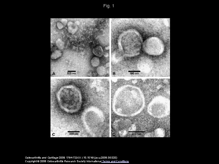 Fig. 1 Osteoarthritis and Cartilage 2009 1764 -72 DOI: (10. 1016/j. joca. 2008. 05.