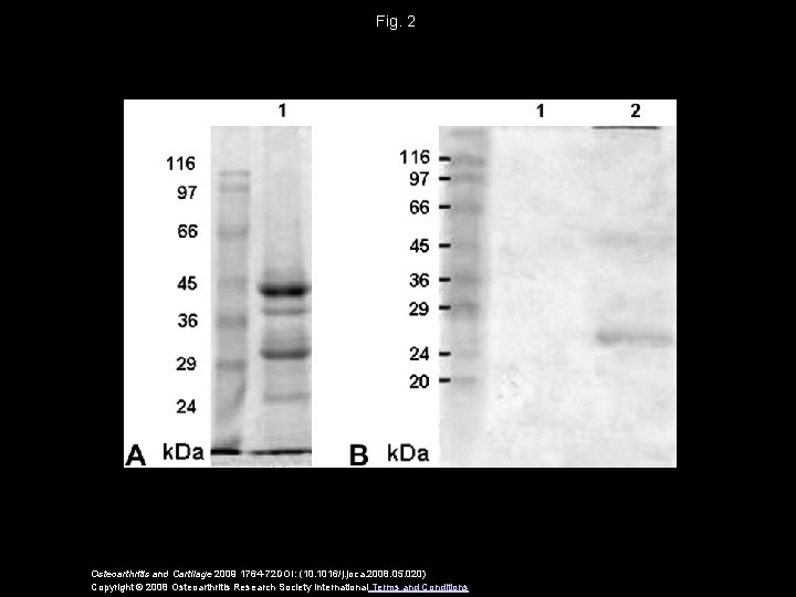 Fig. 2 Osteoarthritis and Cartilage 2009 1764 -72 DOI: (10. 1016/j. joca. 2008. 05.