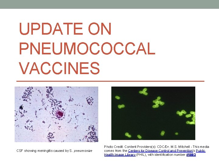 UPDATE ON PNEUMOCOCCAL VACCINES CSF showing meningitis caused by S. pneumoniae Photo Credit: Content