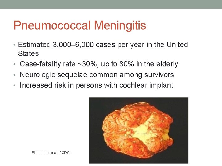 Pneumococcal Meningitis • Estimated 3, 000– 6, 000 cases per year in the United