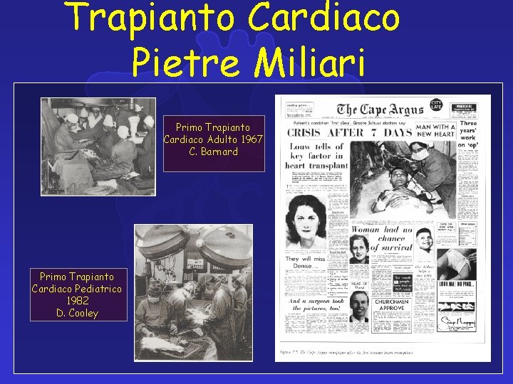 Trapianto Cardiaco Pietre Miliari Primo Trapianto Cardiaco Adulto 1967 C. Barnard Primo Trapianto Cardiaco