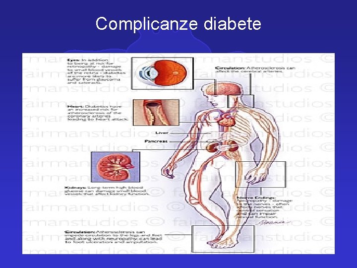 Complicanze diabete 