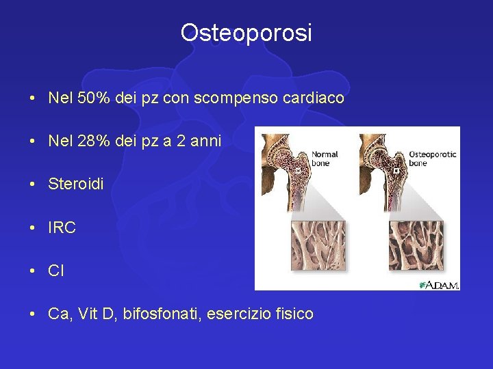 Osteoporosi • Nel 50% dei pz con scompenso cardiaco • Nel 28% dei pz
