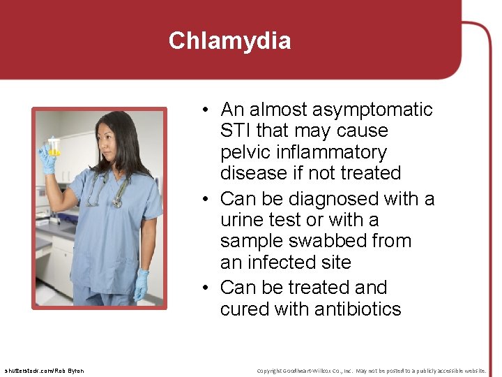 Chlamydia • An almost asymptomatic STI that may cause pelvic inflammatory disease if not