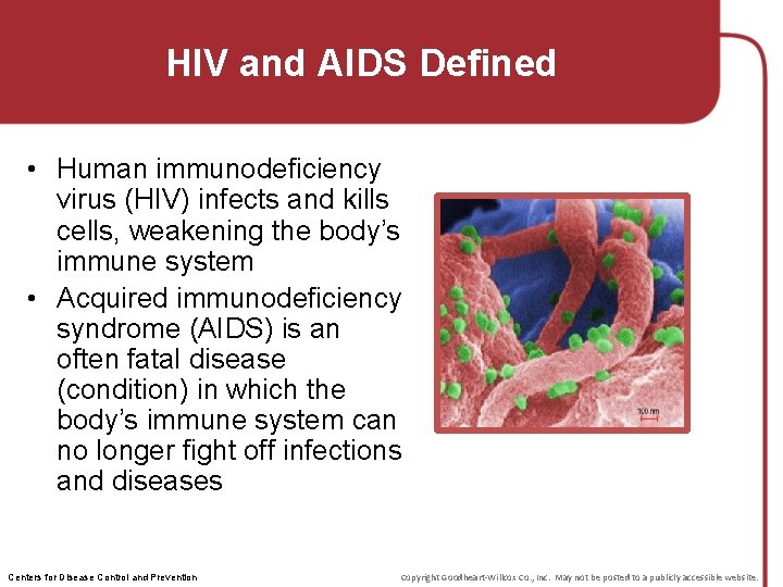 HIV and AIDS Defined • Human immunodeficiency virus (HIV) infects and kills cells, weakening