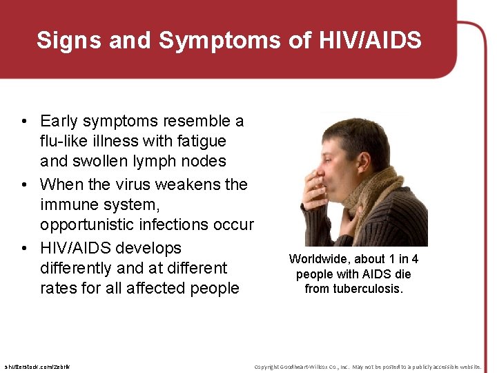 Signs and Symptoms of HIV/AIDS • Early symptoms resemble a flu-like illness with fatigue Signs and Symptoms of HIV/AIDS • Early symptoms resemble a flu-like illness with fatigue
