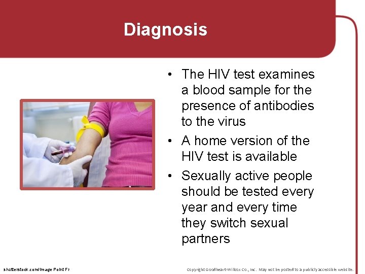 Diagnosis • The HIV test examines a blood sample for the presence of antibodies Diagnosis • The HIV test examines a blood sample for the presence of antibodies