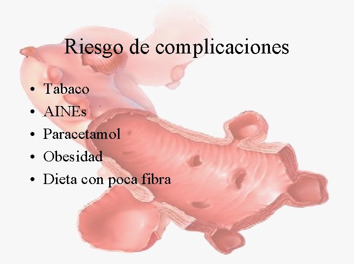 Riesgo de complicaciones • • • Tabaco AINEs Paracetamol Obesidad Dieta con poca fibra