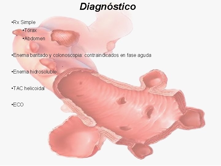 Diagnóstico • Rx Simple • Tórax • Abdomen • Enema baritado y colonoscopia: contraindicados
