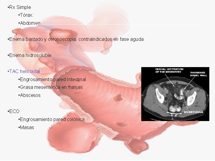  • Rx Simple • Tórax: • Abdomen • Enema baritado y colonoscopia: contraindicados