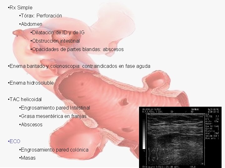  • Rx Simple • Tórax: Perforación • Abdomen • Dilatación de ID y