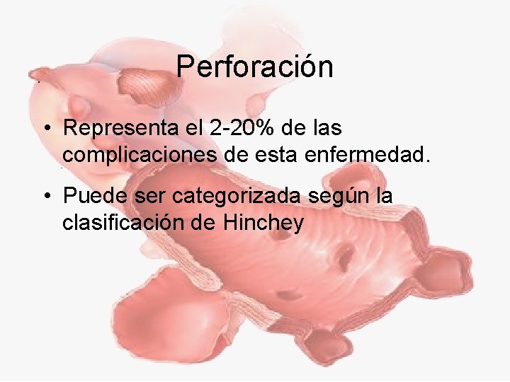 Perforación • Representa el 2 -20% de las complicaciones de esta enfermedad. • Puede