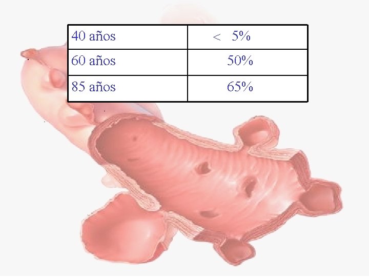 40 años 5% 60 años 50% 85 años 65% 