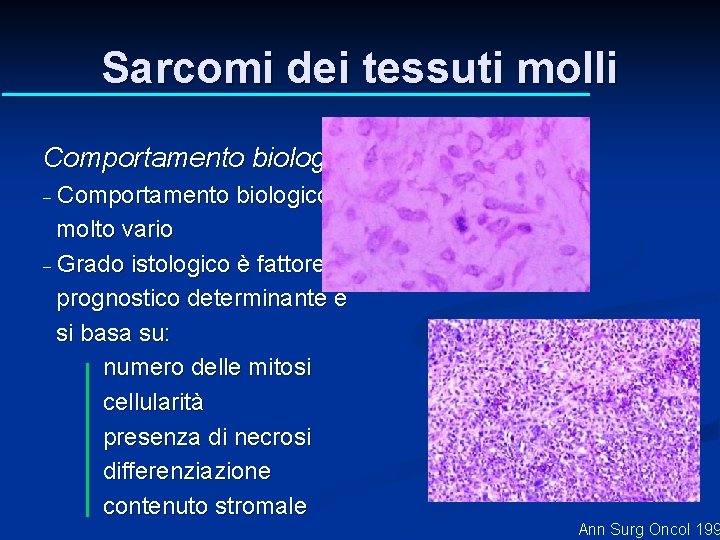 Sarcomi dei tessuti molli Comportamento biologico - Comportamento biologico molto vario - Grado istologico Sarcomi dei tessuti molli Comportamento biologico - Comportamento biologico molto vario - Grado istologico