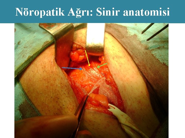 Nöropatik Ağrı: Sinir anatomisi 