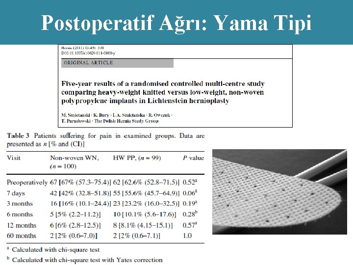 Postoperatif Ağrı: Yama Tipi 