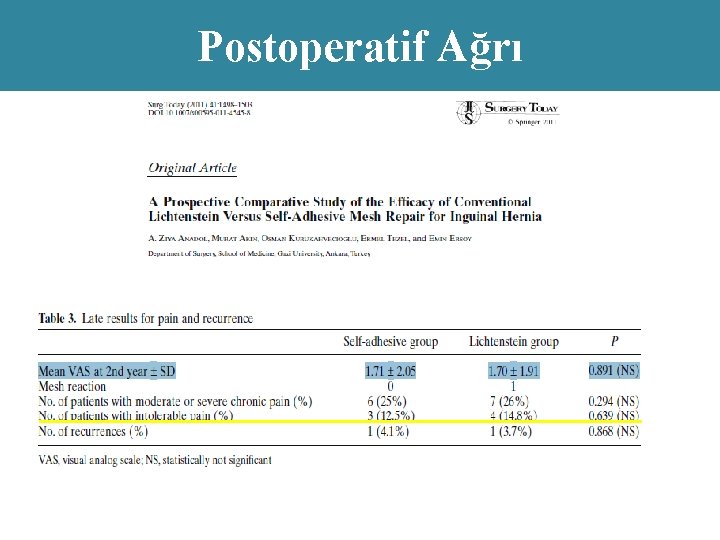 Postoperatif Ağrı 