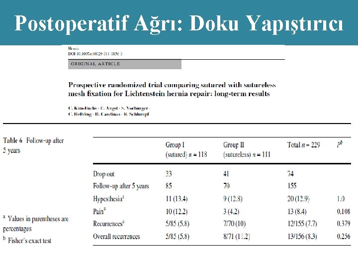 Postoperatif Ağrı: Doku Yapıştırıcı 