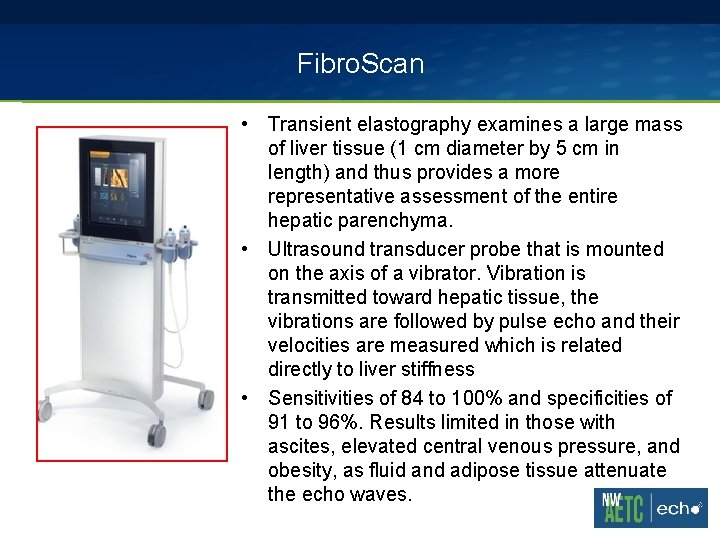 Fibro. Scan • Transient elastography examines a large mass of liver tissue (1 cm