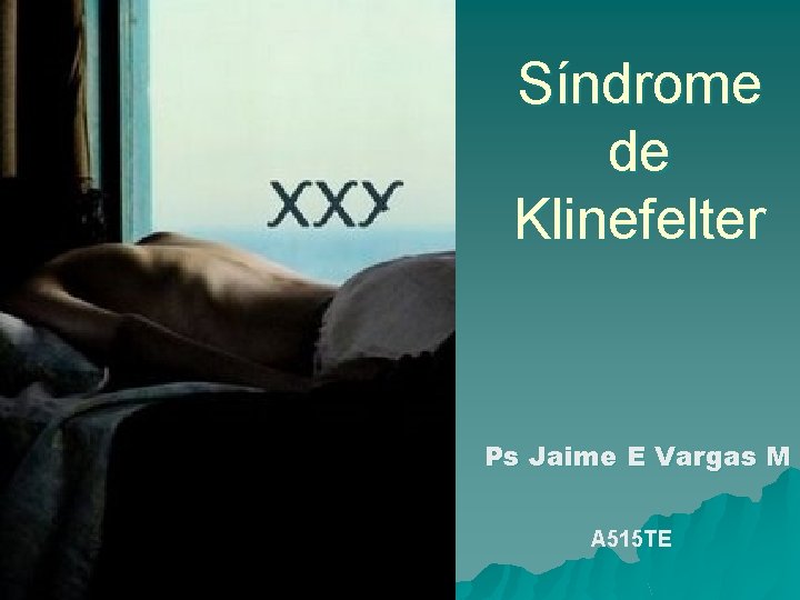 Síndrome de Klinefelter Ps Jaime E Vargas M A 515 TE 