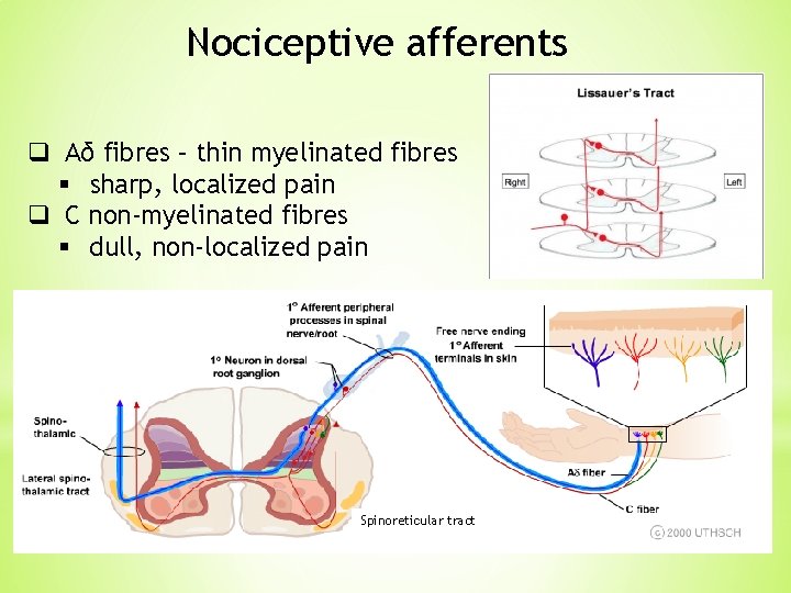 Nociceptive afferents q Aδ fibres – thin myelinated fibres § sharp, localized pain q