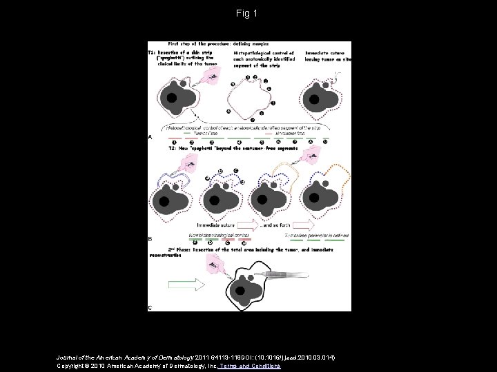 Fig 1 Journal of the American Academy of Dermatology 2011 64113 -118 DOI: (10.
