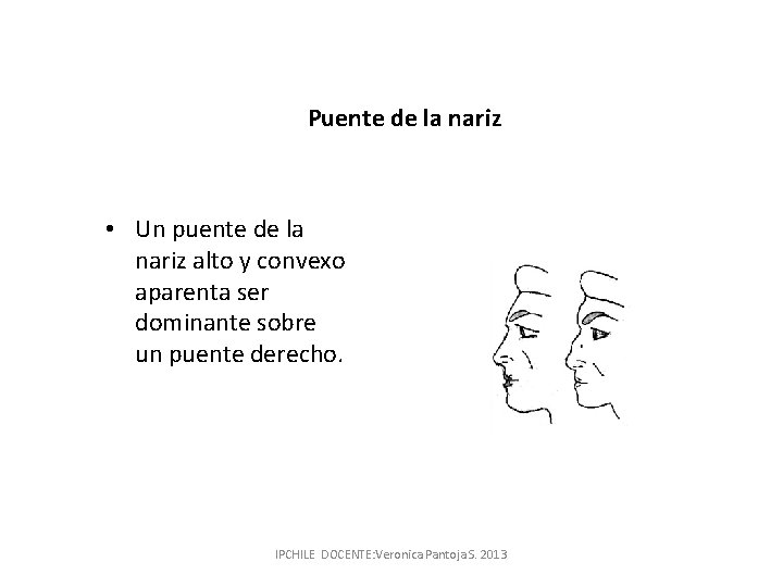 Puente de la nariz • Un puente de la nariz alto y convexo aparenta