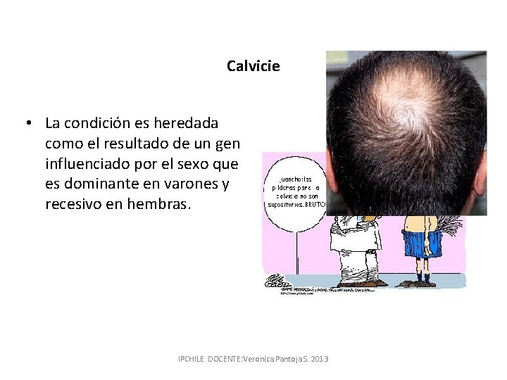 Calvicie • La condición es heredada como el resultado de un gen influenciado por