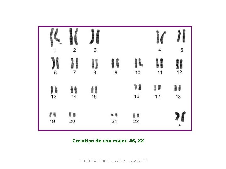 Cariotipo de una mujer: 46, XX IPCHILE DOCENTE: Veronica Pantoja S. 2013 