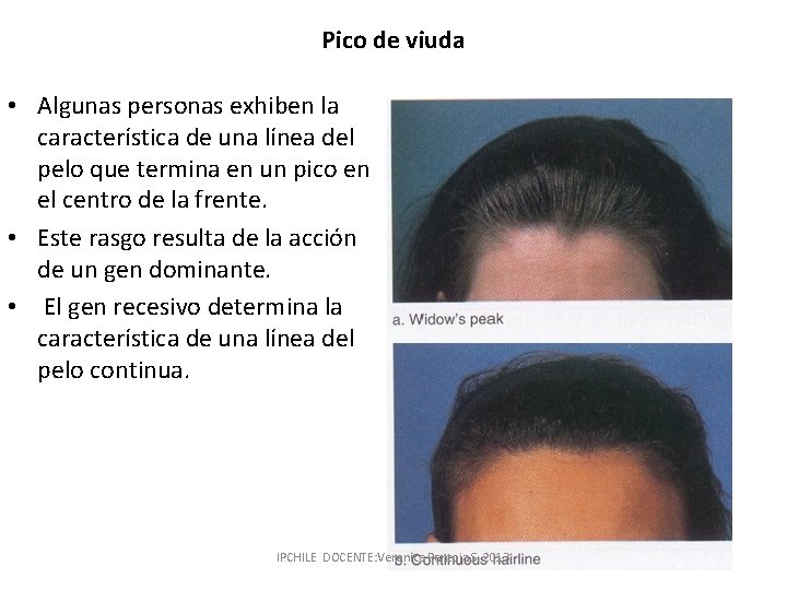 Pico de viuda • Algunas personas exhiben la característica de una línea del pelo