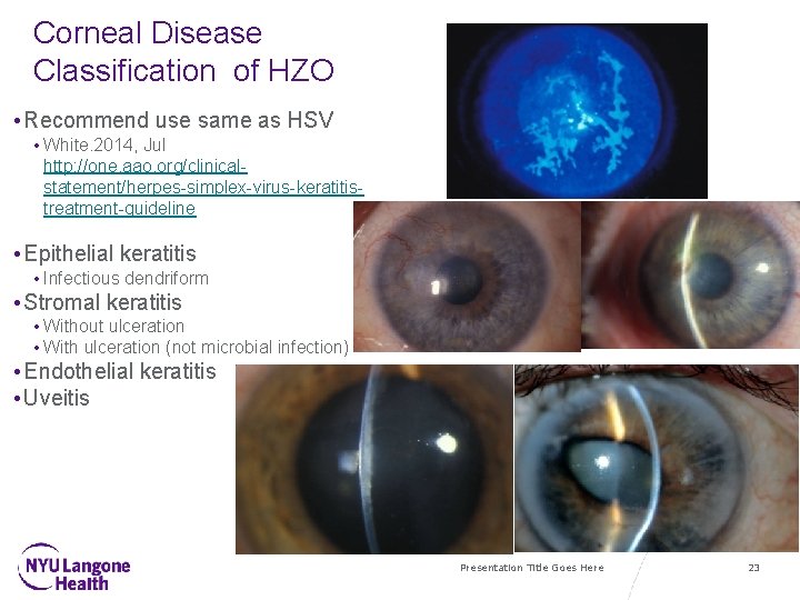 Corneal Disease Classification of HZO • Recommend use same as HSV • White. 2014,