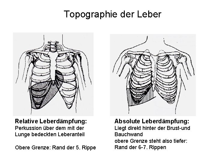 Topographie der Leber Relative Leberdämpfung: Absolute Leberdämpfung: Perkussion über dem mit der Lunge bedeckten