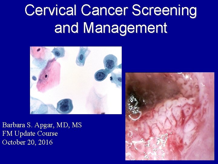 Cervical Cancer Screening and Management Barbara S. Apgar, MD, MS FM Update Course October